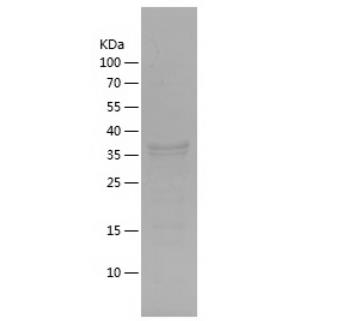 Recombinant Human Cytokeratin 20.png
