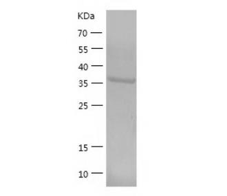 Recombinant Human D Amino Acid Oxidase.png