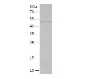 Recombinant Human DCK.png