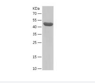 Recombinant Human DCTN6.png