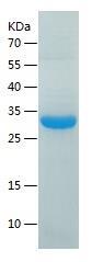 Recombinant Human DCXR.jpg