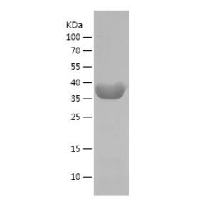 Recombinant Human DDX25.png