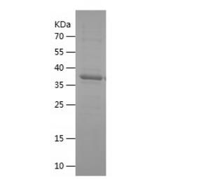 Recombinant Human Decorin.png