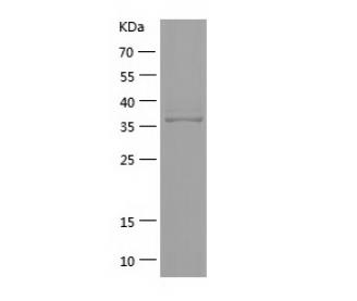 Recombinant Human DENND3.png