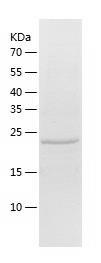 Recombinant Human Desmoplakin.jpg