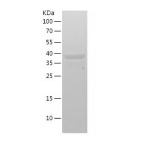 Recombinant Human DGAT1.png