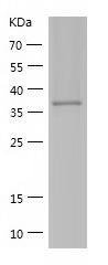 Recombinant Human DHPS.jpg