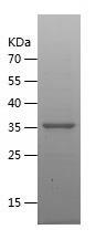 Recombinant Human DHRS9.jpg