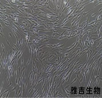 人胃肠道间质瘤细胞GISTT1（STR）