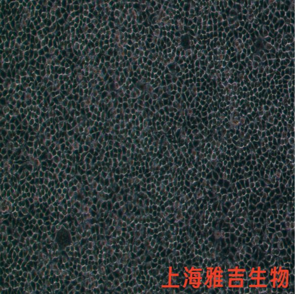 人卵巢癌腺癌细胞OVCAR8（STR）