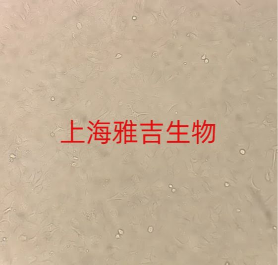 人肝胆管癌细胞SSP25（STR）