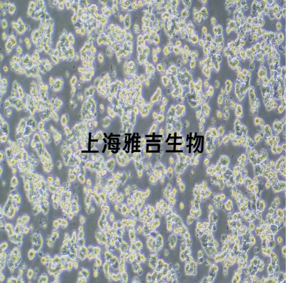 小鼠胰岛素瘤胰岛Beta细胞BetaTC6（STR）