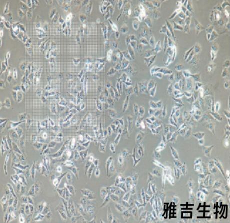 小鼠淋巴瘤细胞EL4（STR）