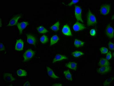 Rabbit anti-Human S100A9 Polyclonal antibody