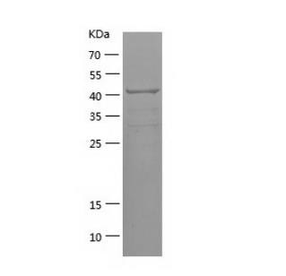 Recombinant Human DICER1.png