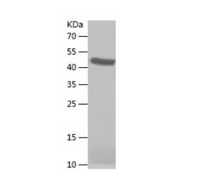 Recombinant Human DIRAS1.png
