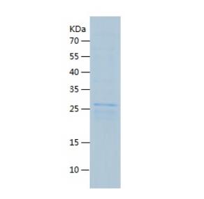 Recombinant Human DKK1.png