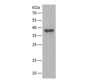 Recombinant Human DNAJB2.png