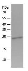 Recombinant Human DNAJB8.jpg