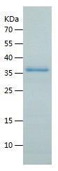 Recombinant Human DNTTIP1.jpg