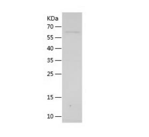 Recombinant Human Dopamine beta Hydroxylase.png