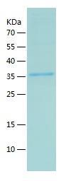 Recombinant Human Dppa4.jpg