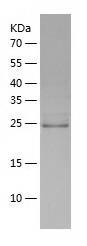 Recombinant Human DTYMK.jpg