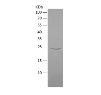Recombinant Human DYRK4.png