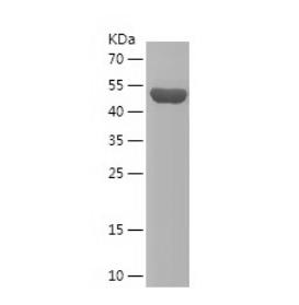 Recombinant Human ECH1.png