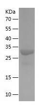 Recombinant Human ECHDC1.jpg