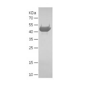 Recombinant Human ECHS1.png