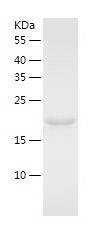Recombinant Human ECSIT.jpg