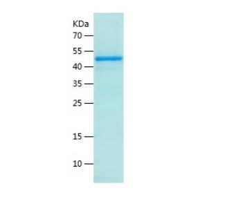 Recombinant Human EED.png