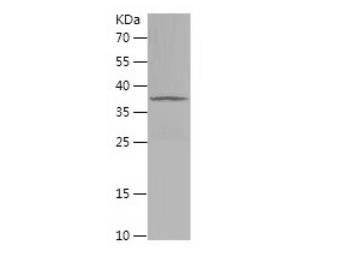 Recombinant Human EEF1D.png