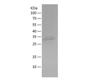 Recombinant Human EHD1.png