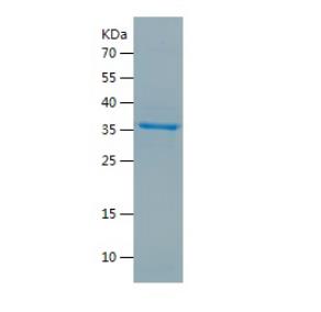 Recombinant Human EIF2A.png