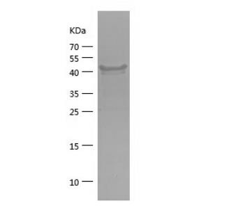 Recombinant Human EIF2AK1.png