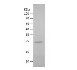 Recombinant Human ERG.png
