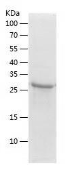 Recombinant Human ERGIC3.jpg