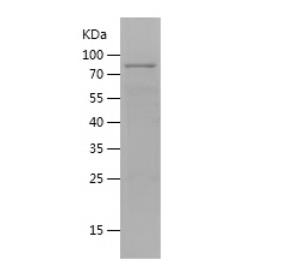 Recombinant Human ERVK-6.png