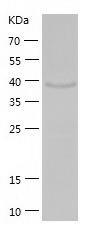 Recombinant Human ETNK2.jpg