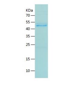 Recombinant Human FARS2.png