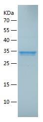 Recombinant Human FCRL6.jpg