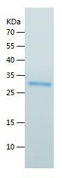 Recombinant Human FGF 23.jpg