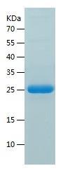Recombinant Human FGF20.jpg