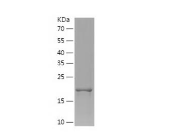 Recombinant Human FGF8.png