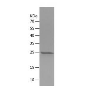 Recombinant Human FGF9.png