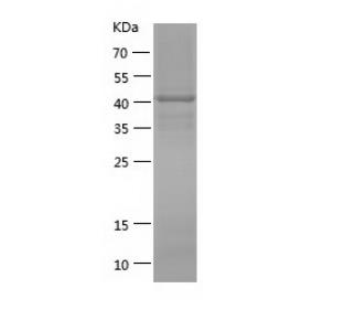 Recombinant Human FGFR1.png
