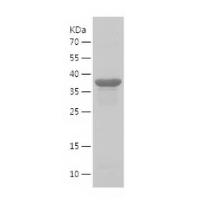 Recombinant Human FH.png