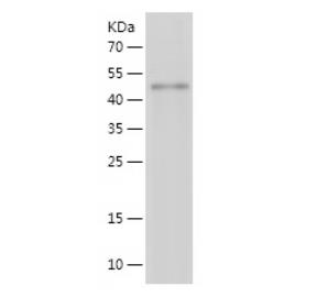 Recombinant Human FHL3.png
